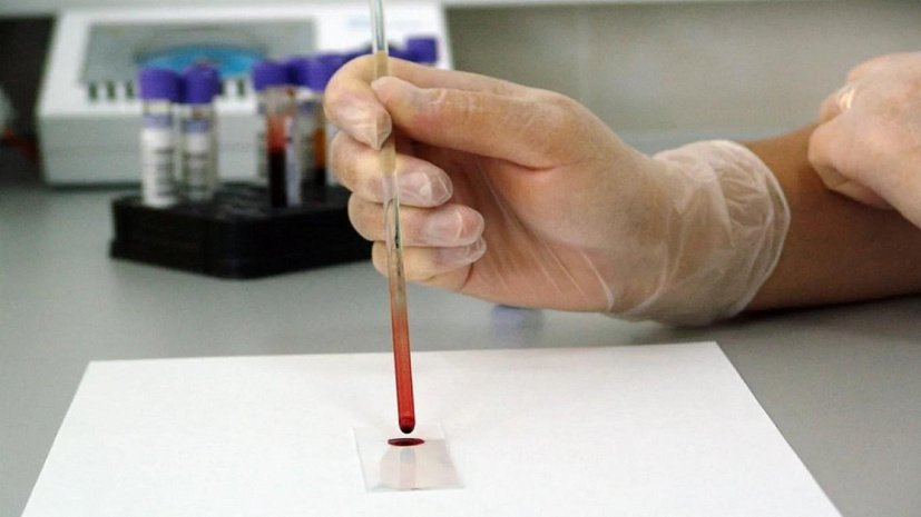 Наиболее уязвимую для коронавируса группу крови назвали в России
